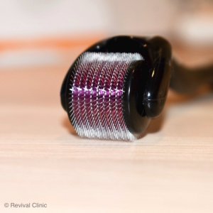 Revix Clinic|Dermaroller