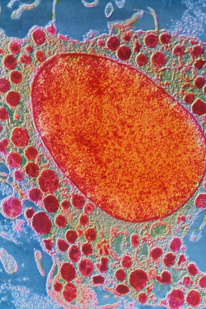 Revix Clinic | What is your inflammation level?