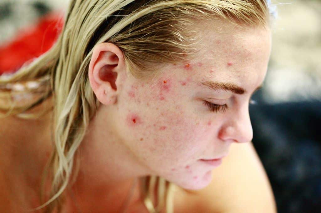 Revix Clinic | Food for Thought: What to Eat (and Avoid) for Clearer Skin