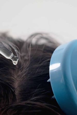 scalp treatment