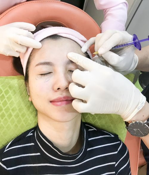 Revix Clinic | Why You Still Have Dark Eye Circles (Even If You’re Sleeping Well)