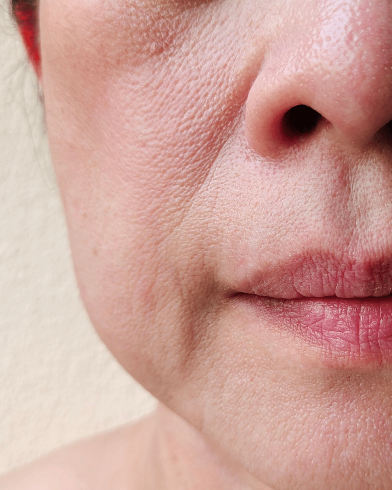 Revix Clinic | Facial Sagging Explained: A Comprehensive Guide to Understanding and Restoring Firmness Naturally aesthetic clinic kota kemuning