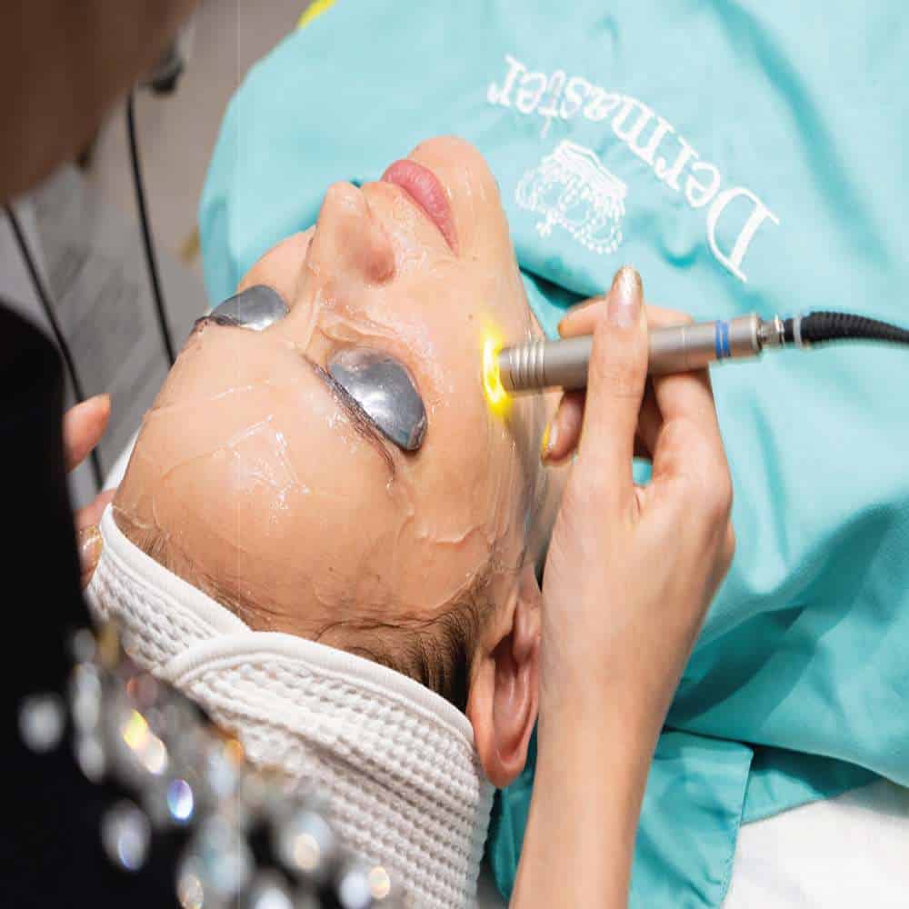 Revix Clinic | Dual Yellow Treatment dual yellow laser